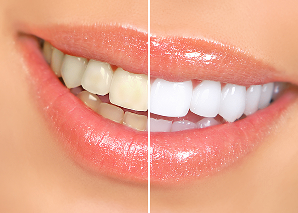 Northeast Portland Cosmetic Dentist Dr. Daby can give you the smile of your dreams!